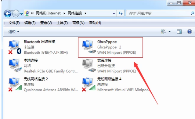 設(shè)置寬帶